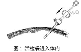 一次性使用內(nèi)窺鏡用活檢袋注冊審查指導(dǎo)原則（2025年第20號(hào)）(圖1)