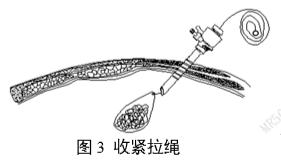 一次性使用內(nèi)窺鏡用活檢袋注冊審查指導(dǎo)原則（2025年第20號(hào)）(圖3)